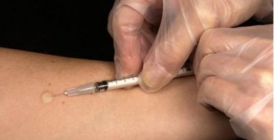 La lucha contra la tuberculosis, v&iacute;ctima colateral del coronavirus
