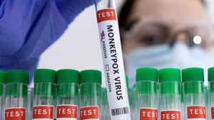 China autoriz&oacute; la comercializaci&oacute;n del primer kit de pruebas para detectar la viruela del mono